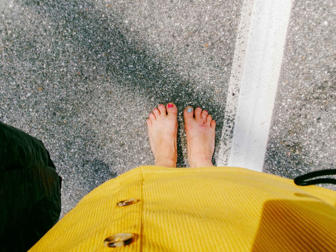 A pair of blistered feet on pavement.