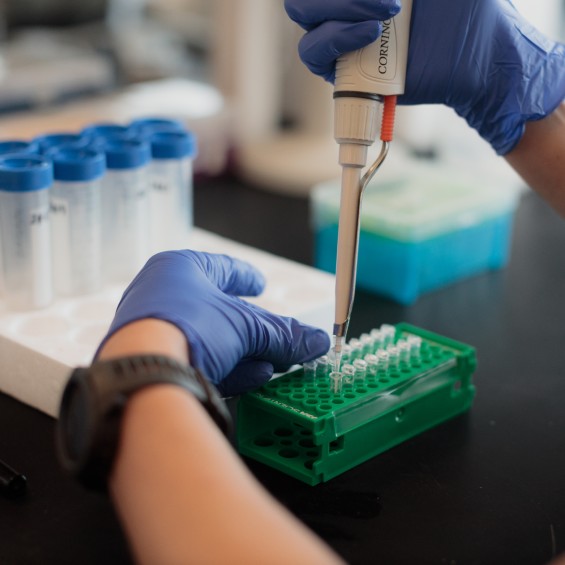A scientist is preparing samples for polymerase chain reaction (PCR). A micropipette is poised above a 150 uL microcentriguge tube 